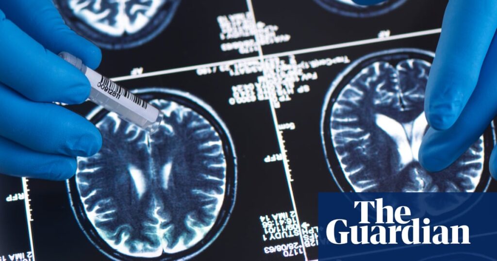 Brain tumour diagnosis could be made within hours, say researchers | Cancer research