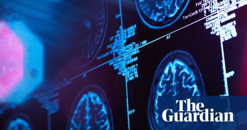 Canada medical mystery takes twist as study finds no evidence of brain illness | Canada