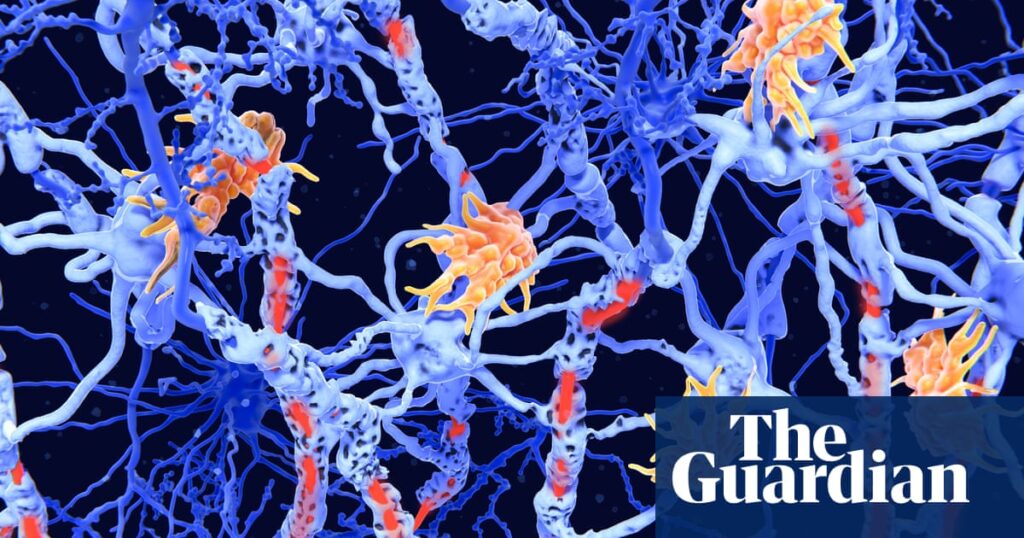 ‘Inverse vaccines’: the promise of a ‘holy grail’ treatment for autoimmune diseases | Well actually