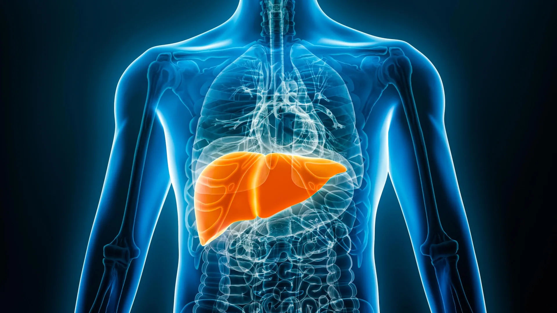 AI sees what doctors miss: Fatty liver disease hidden in chest x-rays