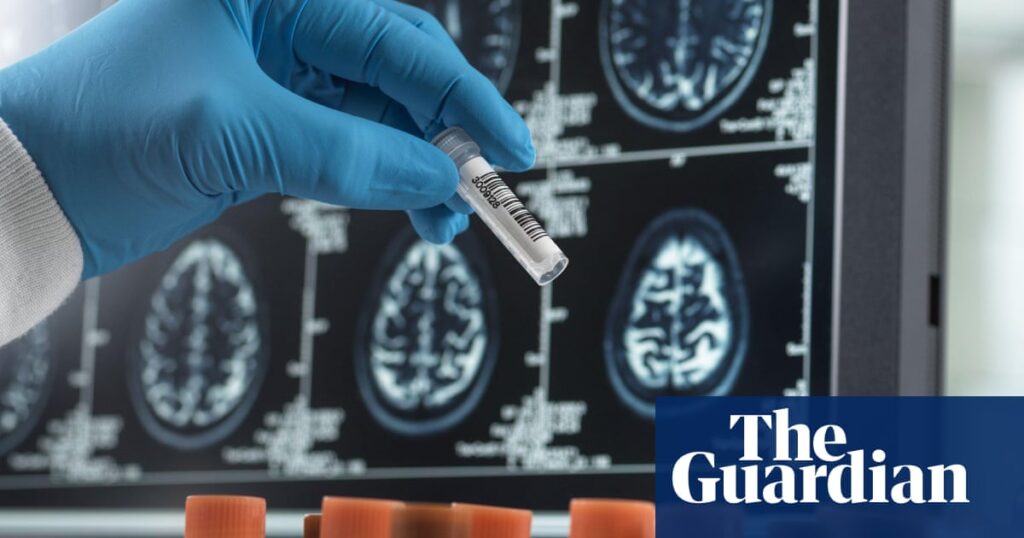 Alzheimer’s blood test can spot people with early symptoms, study suggests | Alzheimer's