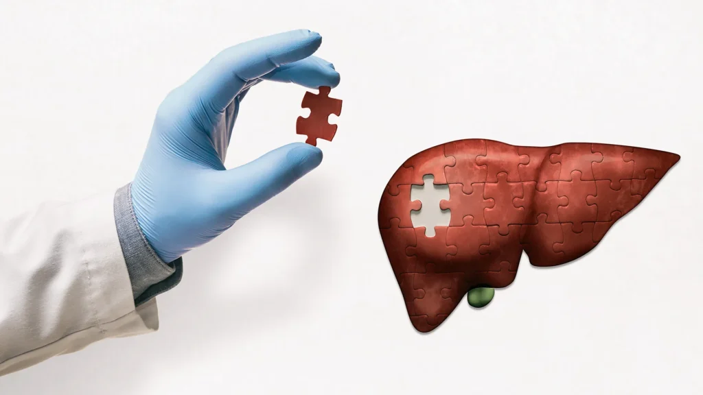 Clinical trial finds diabetes pill reduces liver scarring