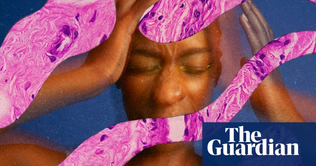 Doctors dismissed my pain. I eventually discovered I had a rare tumor | Well actually