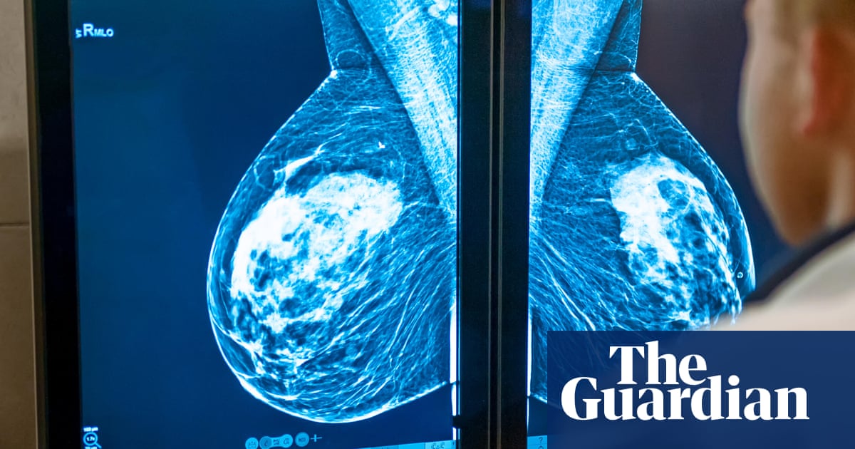 Key takeaways from world’s largest cancer conference in Chicago | Cancer