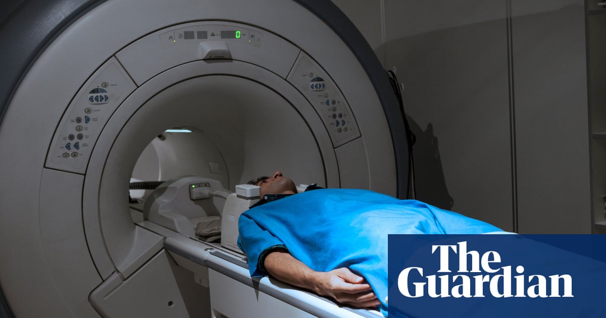 Millions in west do not know they have aggressive fatty liver disease, study says | Health