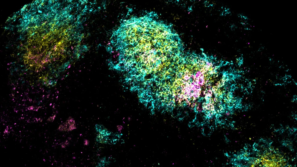 One shot to stop HIV: MIT's bold vaccine breakthrough