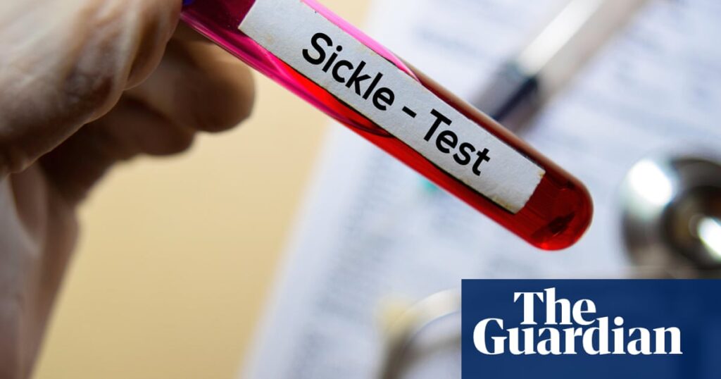 Sickle cell patients to have quicker and more accessible treatment in England | Sickle cell disease