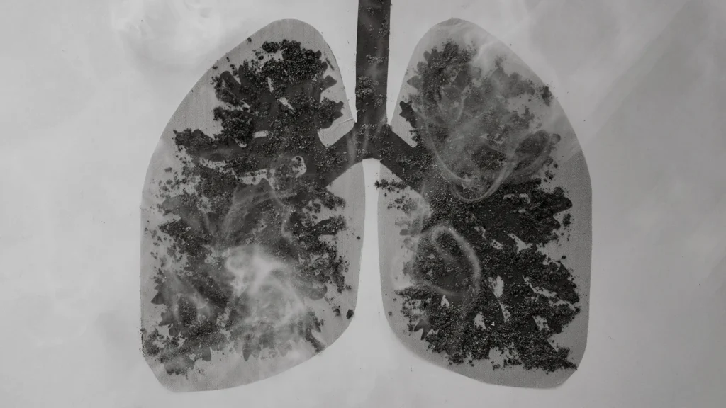 Unusual carbon build-up found in lungs of COPD patients