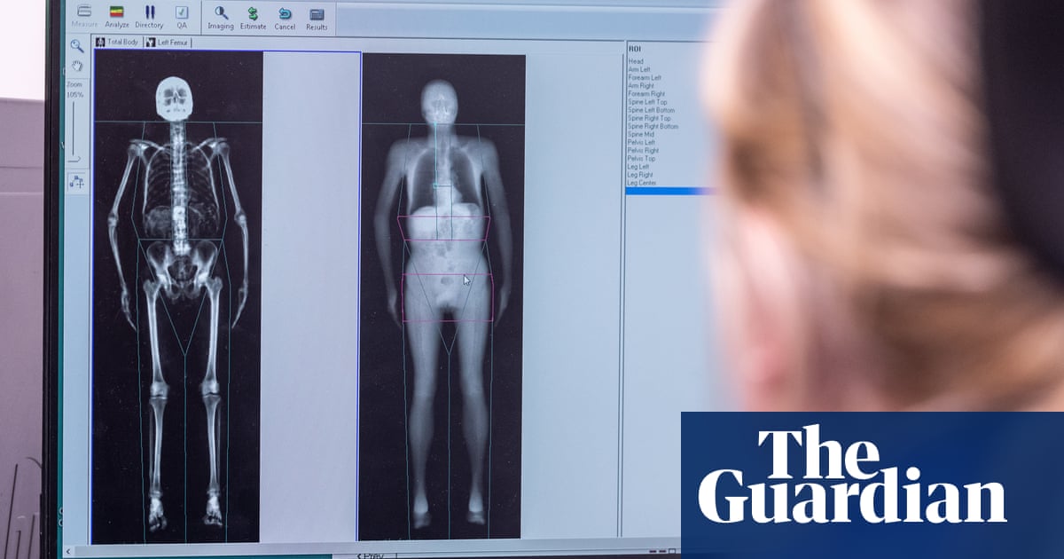 Full-body scans of 100,000 people could change way diseases are detected and treated | Medical research