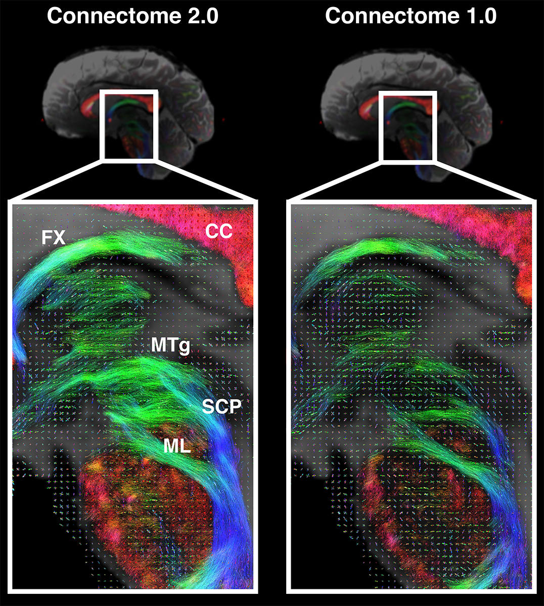 Scientists Develop High-Performance MRI Scanner in Effort to Define Microscopic Brain Structures