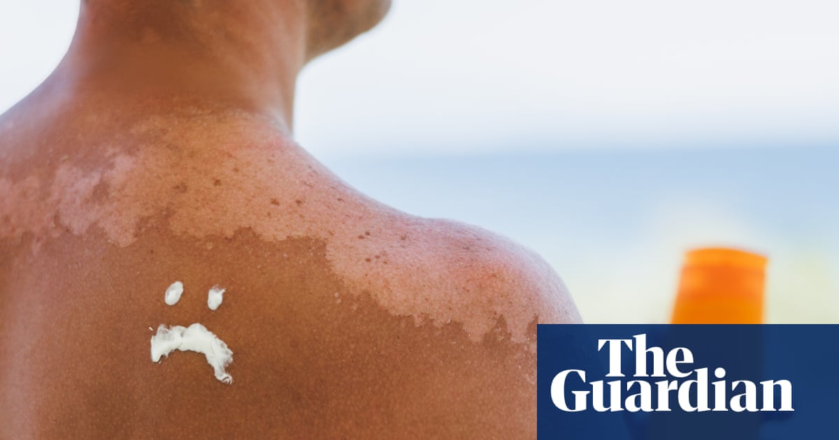 As influencers spread ‘toxic’ claims, what is the truth about sunscreen? | Science