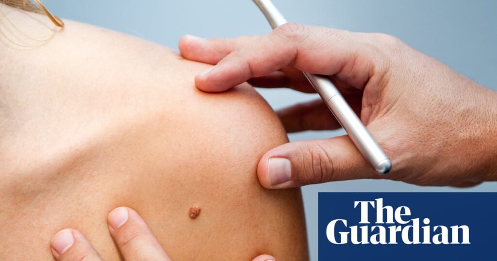 Be warned about the dangers of tanning | Skin cancer