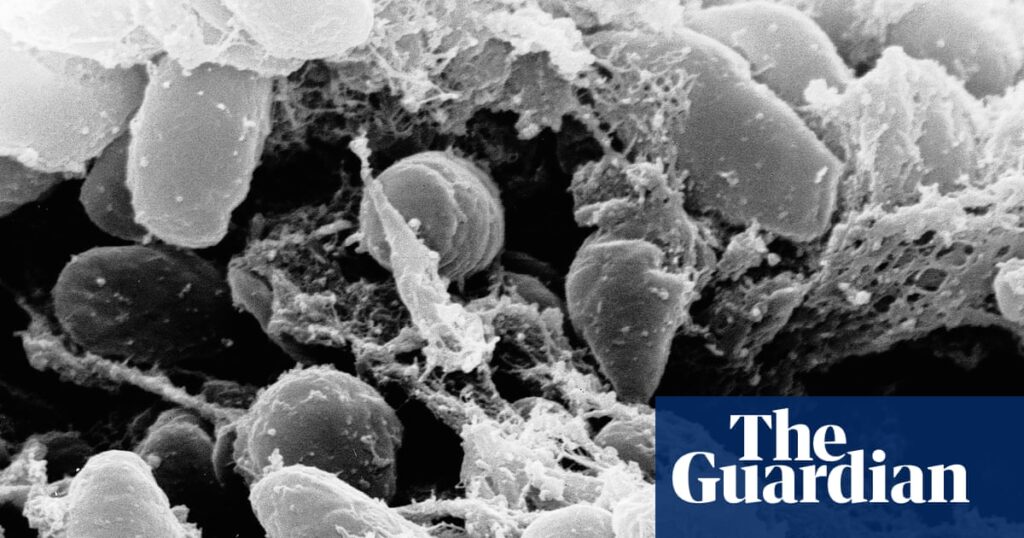 California resident tests positive for the plague after camping, officials say | California