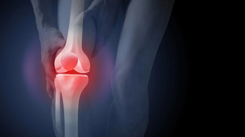 The surprising reason x-rays can push arthritis patients toward surgery