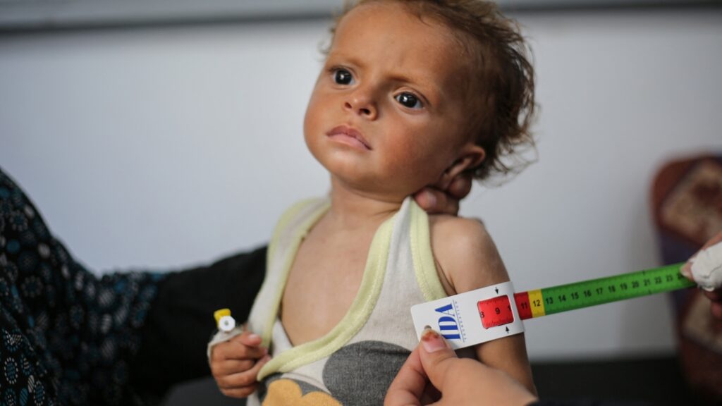 What does it take to make this pronouncement? : Goats and Soda : NPR