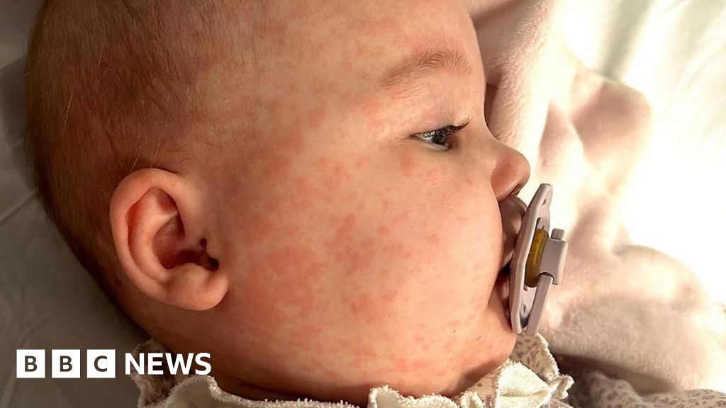 County Durham mother's vaccination plea after 'terrifying' measles