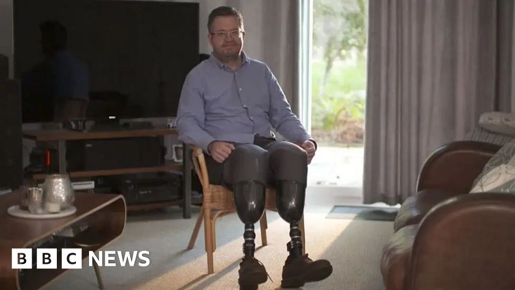 Surgeon Neil Hopper admits fraud over amputation of own legs